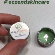 How to Cure Eczema A Psoriasis Permanently | Eczend